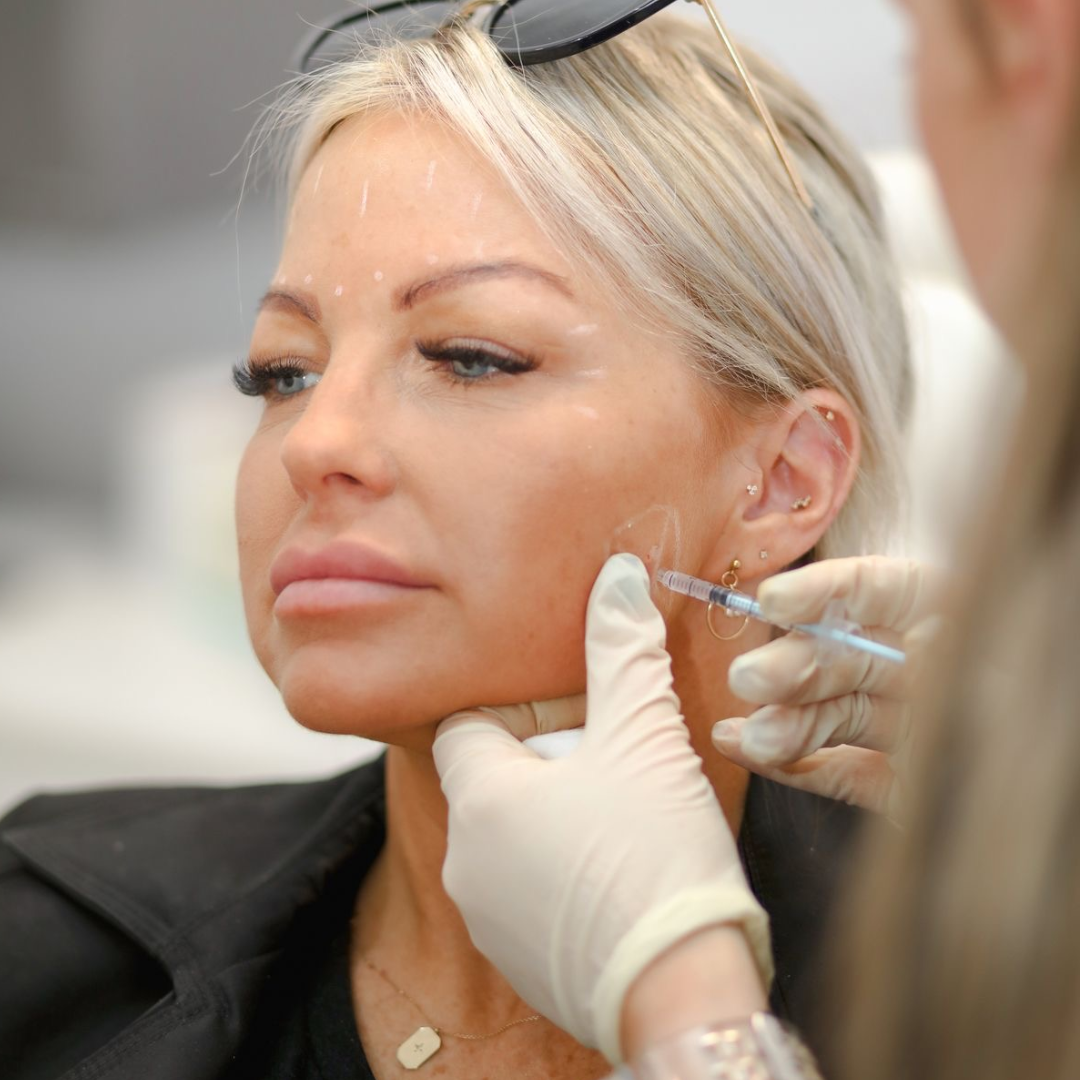 ANTI-WRINKLE INJECTIONS (UPPER FACE)