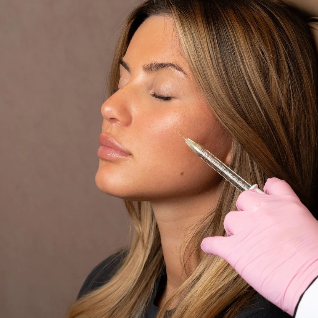 Dermal Filler Facial Contouring