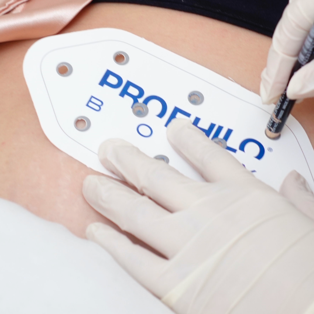 PROFHILO® SKIN BOOSTER (Premium Bioremodelling Treatment)