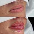 LUMI PRO LIP BOOSTER