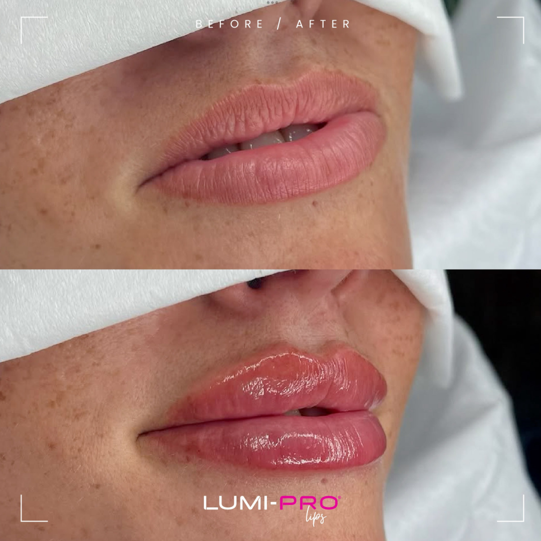 LUMI PRO LIP BOOSTER