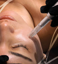 DERMAPEN MICRONEEDLING