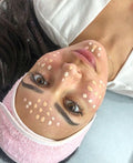 MICRONEEDLING BB GLOW FACIAL
